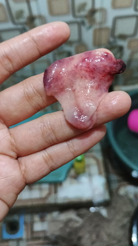 Bun sya kmrin haid, pg ini td sya ngluarin kya gini .perut rsanya kram, kira2 ini apa ya bun??