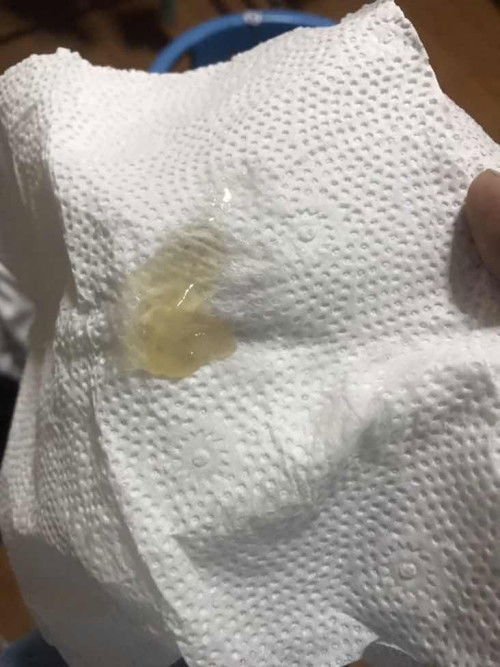 สอบถามแม่ๆค่ะ