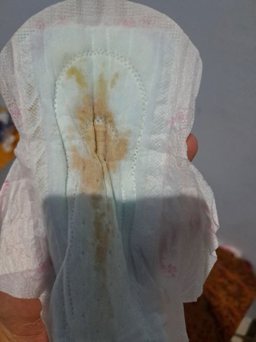 Keluar cairan coklat di usia 35w