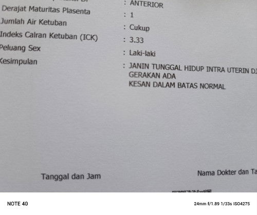 Kepo dikit boleh bunsay semua, hpl juli agustus udah pada tau baby lk atau pr belum?