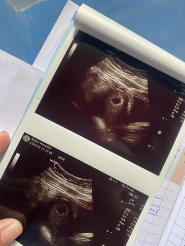 แม่ๆๆบ้านไหนซาวด์เจอน้องตอนอายุครรภ์เท่าไหร่คะ