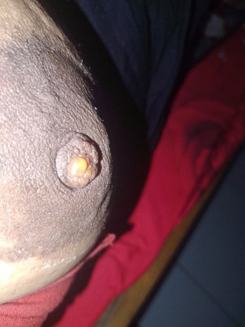 Gara gara pompa terusssss