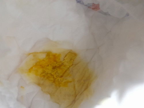 สอบถามเเม่ๆค่ะสีอึแบบนี้ปกติไหมคะ