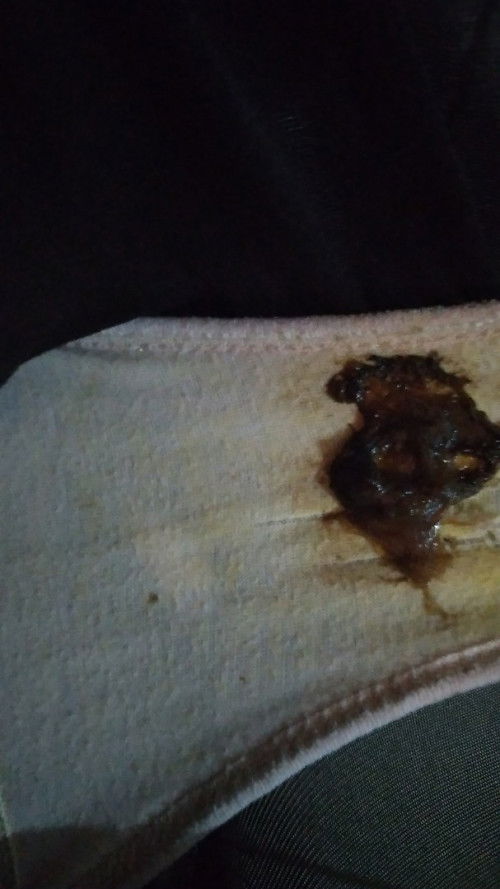 Bun maaf sedikit aga jorok mau nanya kalau misalkan kaya gnh ini tandanya apa yah bund