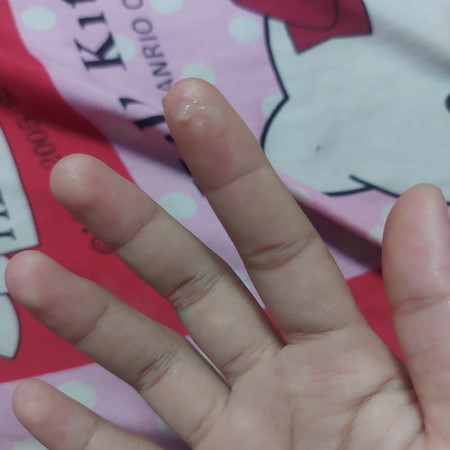 อาการใกล้คลอด