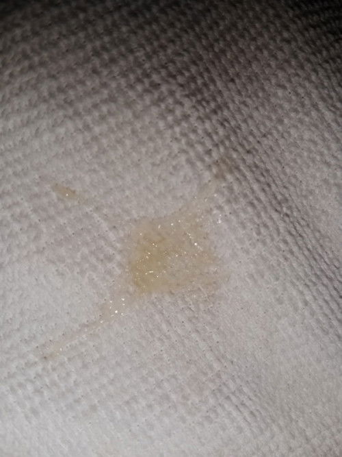 normal ke keputihan macam ini?saya dh nak masuk 9 week