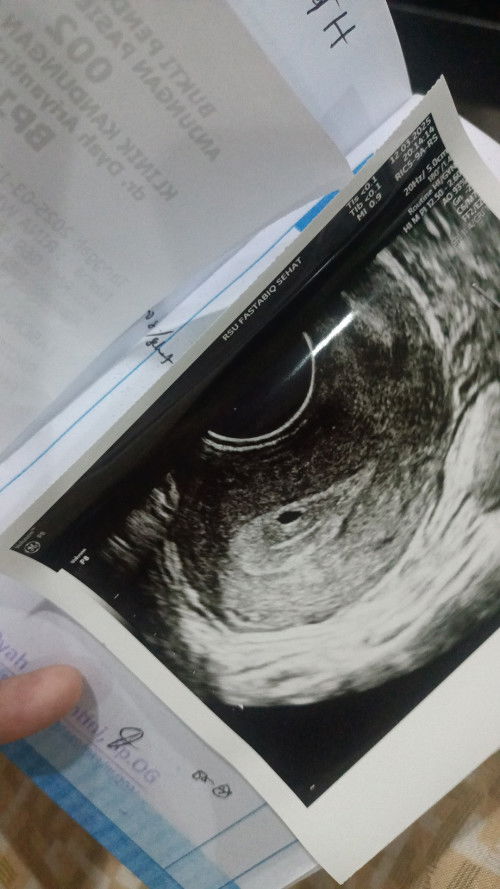 Tespack berubah ubah