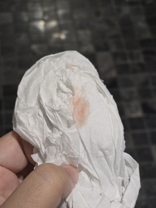 ท้อง 5 เดือน มีเลือดจางๆ