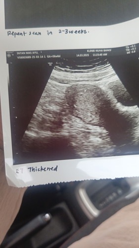 6w6d pregnant