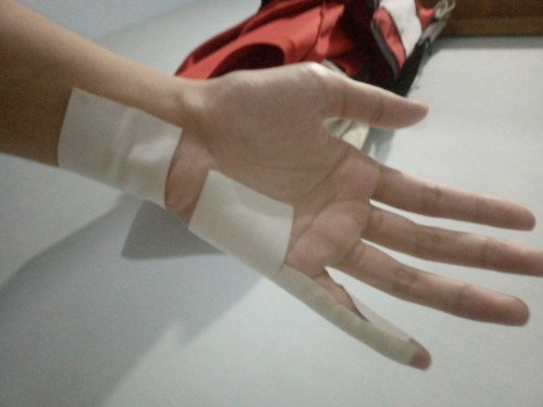 tangan kiri sakit tm 1