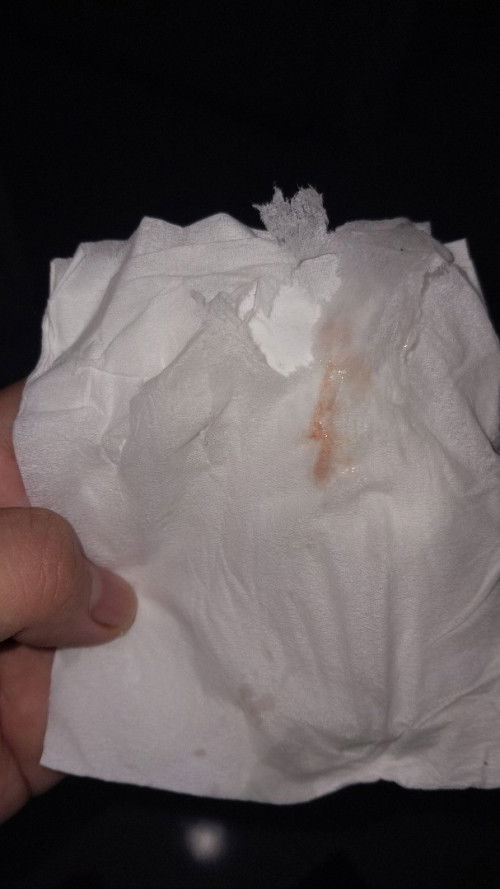 Flek tanda melahirkan