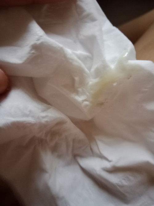 maaf ya kalau gambar ini kotor...nak tanya normal ke keputihan macam ini masa 9week?!