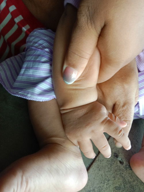 เกิดจากสาเหตุอะไรคุนแม่เสยๆๆน้องก็เป้นผื่นแบบนี้ขึ้นมา