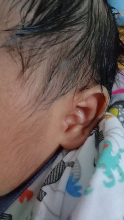 Lahiran caesar hpl 4 maret lahir 5 maret