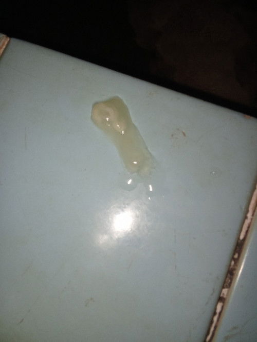 อายุครรภ์39+1