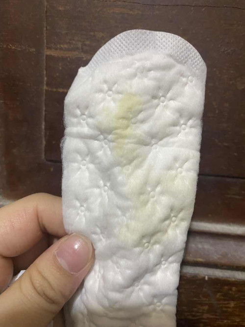 light greenish discharge