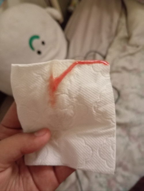 แบบนี้ต้องรีบไปรพ.ใช่ไหมคะ