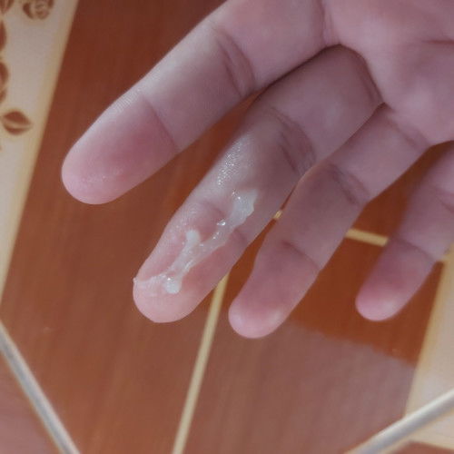 อาการใกล้คลอด