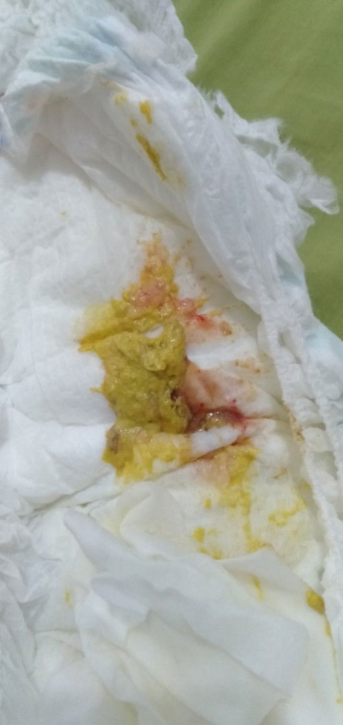 Pencernaan bayi pasca mpasi