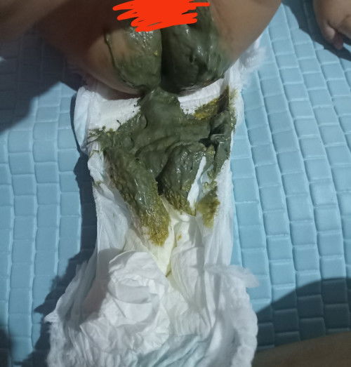 Wajar gak sih warna pup kaya gini fi bayi 4 bulan