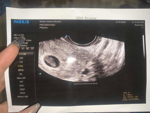 8w dinyatakan djj tidak ada harus kur3t