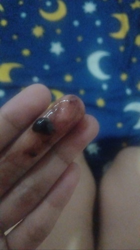 Hamil 19 minggu keluar darah tanda apa ya bun ?