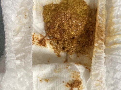 สอบถามเรื่องอึน้อง