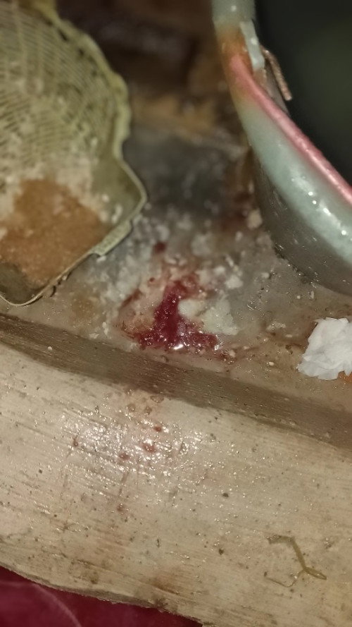 Bun ini kenapa ya setiap mual berlebihan keluar darah gini