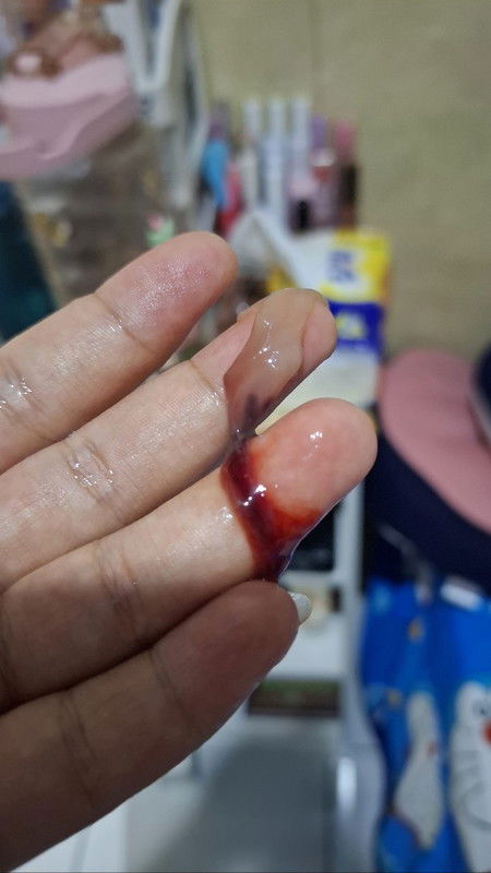 Keluar lendir dan darah