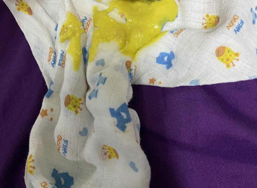 Nak tanya ? Berak baby newborn