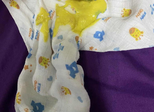 Nak tanya ? Berak baby newborn