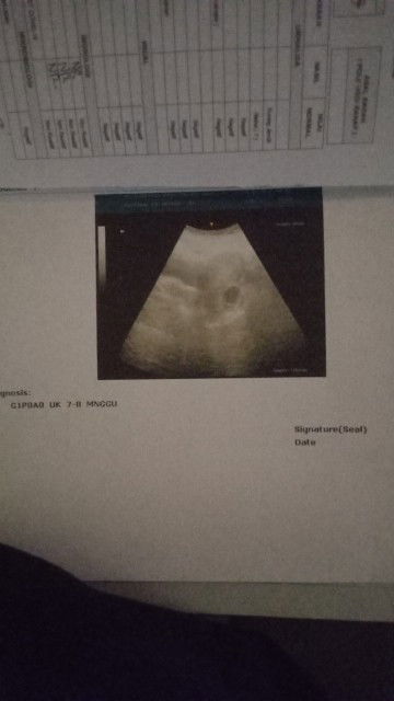 Apa bner ya bun usia 8wk di usg msih segitu bimbang jdinya 🙈