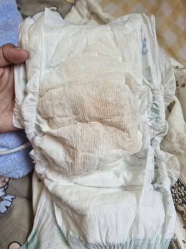 ลูก2เดือน ฉี่แบบนี้ผิดปกติไหมคะ