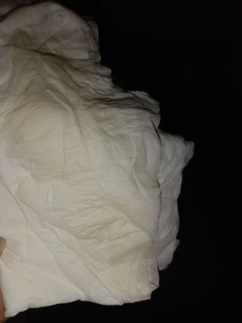 ขอสอบถามเเม่ๆหน่อยนะคะมีสีเหลืองออกมาจากช่องคลอดใช่ตกขาวมั้ยคะมีกลิ่นเหม็นด้วยค่ะเเม่ๆ🙏🏻