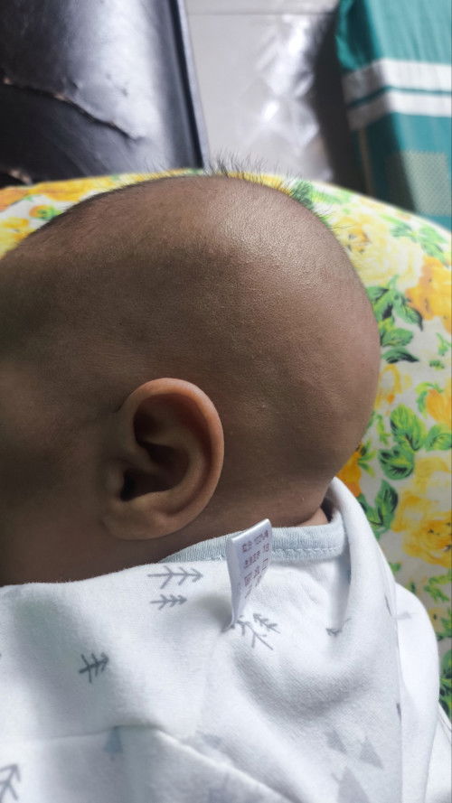 หัวแบนหรือทุย