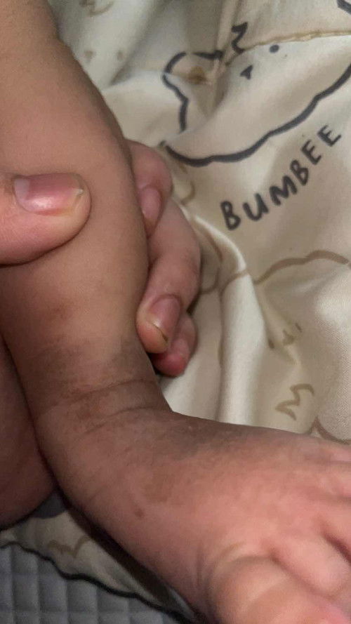 kulit bayi 2 bulan kasar