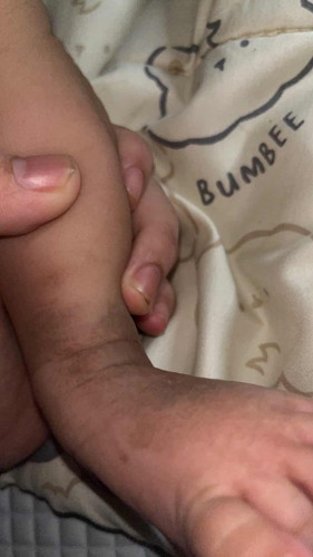 kulit bayi 2 bulan kasar