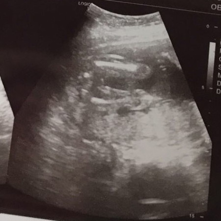 แม่ๆคิดว่าเพศลูกเป็นเพศอะไร แม่บ้านนี้ดูไม่ออกช่วยดูให้หน่อยค่ะ