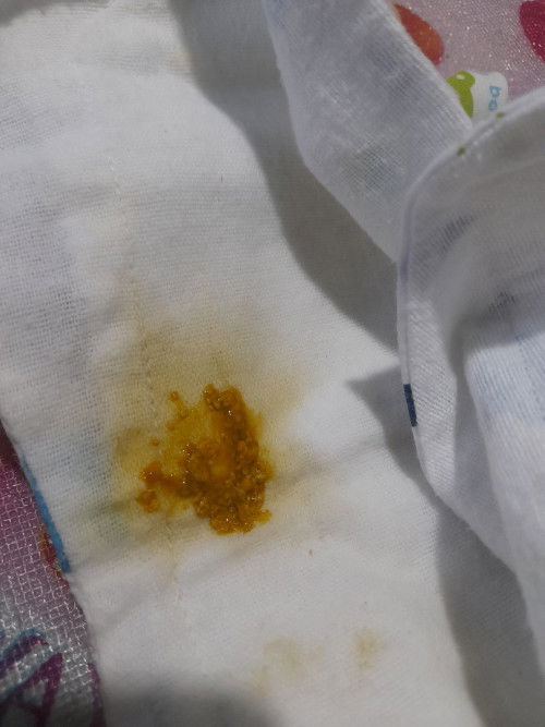 อึแบบนี้ปกติไหมคะ