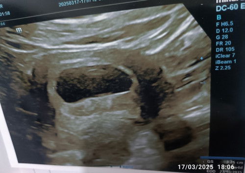 8 Minggu baru kantong