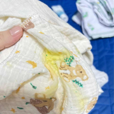 สอบถามแม่ๆลูกบ้านไหนลูกแหวะ เป็นสีเหลืองเป็นสีเหลืองบ้างค่ะ