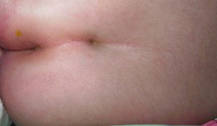 Normal lg ba ito sa baby ?