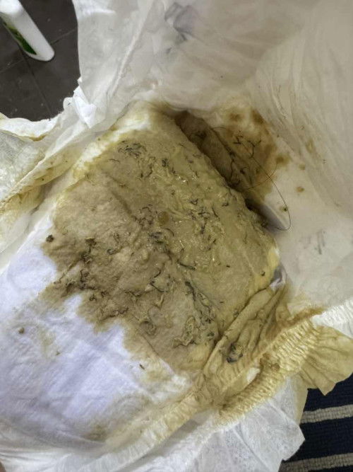 Hai nak tnya ini kenapa ya najis jadi mcm ni skrng dia tgh muntah ii