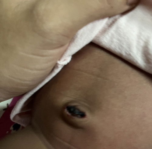 สอบถามแม่ๆหน่อยค่ะ