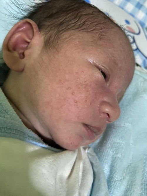 เด็ก14วัน แบบนี้เรียกว่า