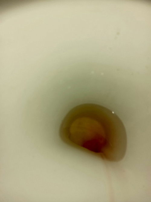 Spotting 7 weeks and 3days. share ko lng my experience