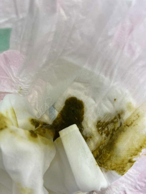 สอบถามแม่ๆค่ะ