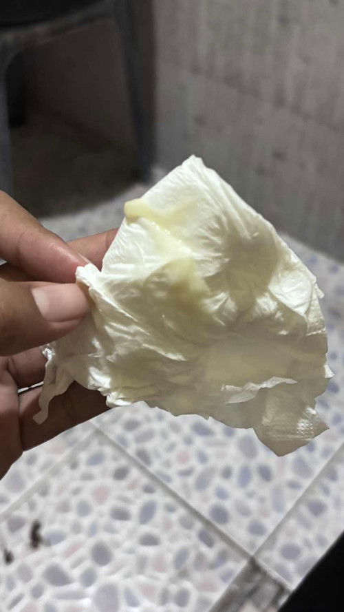 สอบถามแม่ๆหน่อยค่ะตกขาวแบบนี้ปกติมั้ยค่ะ