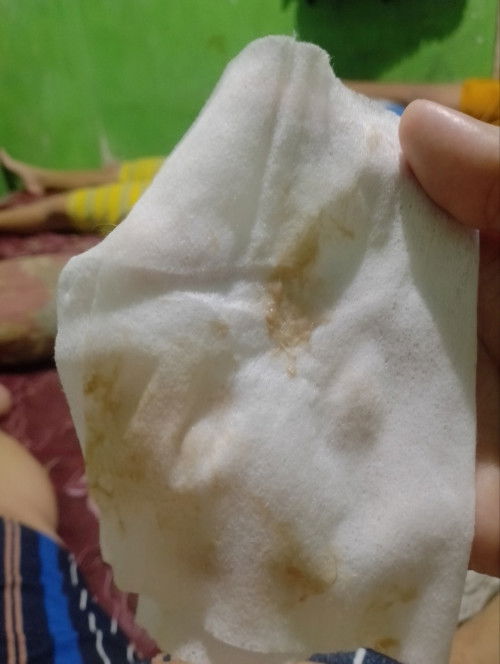 Keluar flek dari kemaren tapi Tanpa kontraksi