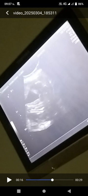 อยากให้แม่ๆช่วยดูว่าน้องเป็นผญ หรือ ผช ค่ะ